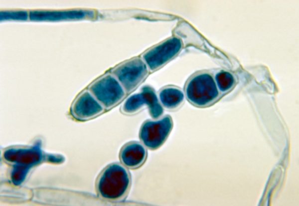 Epidermophyton floccosum под микроскопом