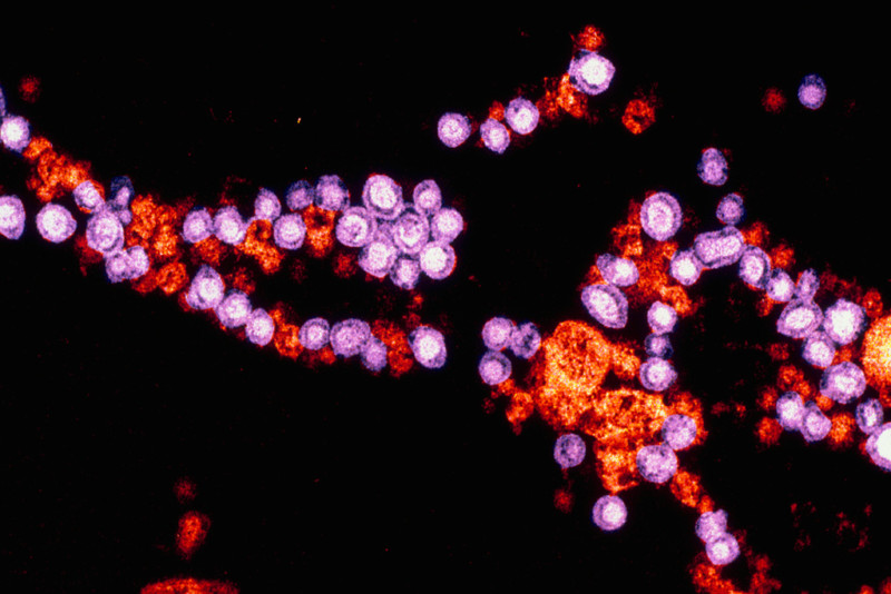 Вирус краснухи под микроскопом