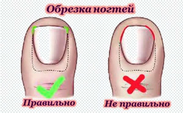Правило обрезки ногтей на ногах