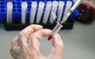 Как проходит ВПЧ скрининг