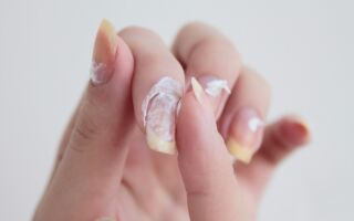 Причины и методы лечения желтых ногтей на руках у женщин