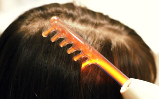 Особенности дарсонвализации волосистой части головы