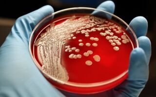 Особенности и опасность золотистого стафилококка (Staphylococcus aureus)