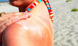 Почему возникает и как лечить фотосенсибилизацию кожи