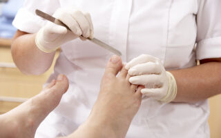 Лечение грибка ногтей на ногах в домашних условиях