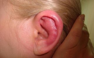 Лечение и причины появления прыщей на мочках ушей