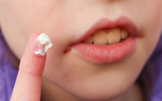 Лечение вируса герпеса на губе у детей