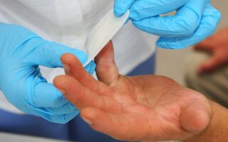 Методы лечения панариция пальца руки