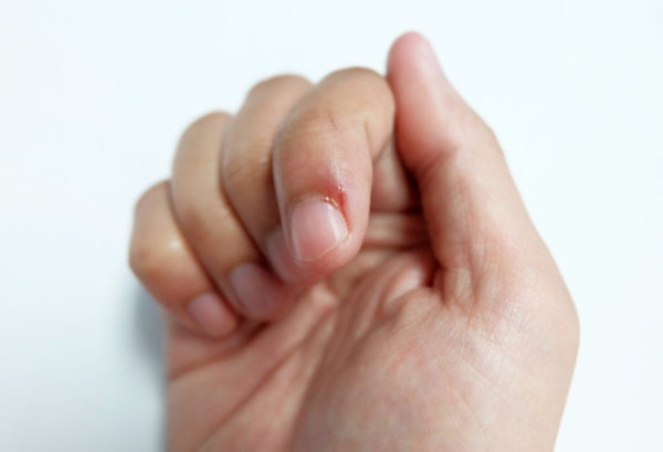 Диагностика по ногтям пальцев рук 63